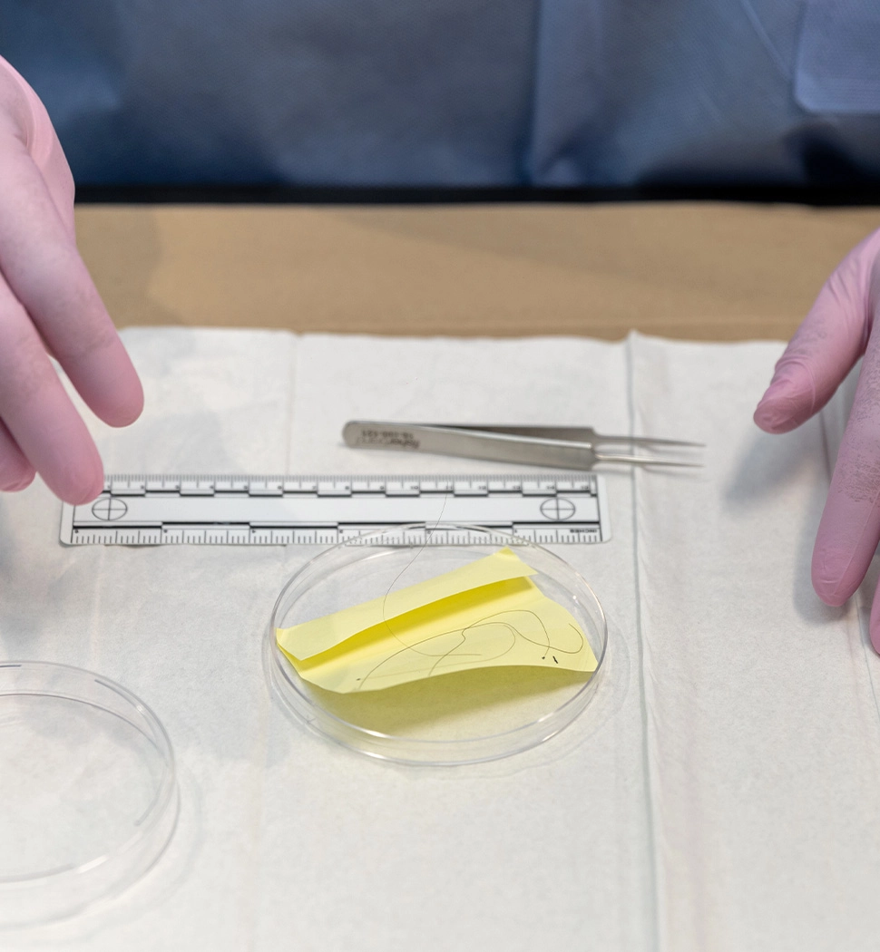 rootless hair shaft evidence